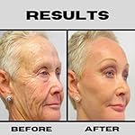 Retinol + Niacinamide B3, Vitamin C, Hyaluronic Acid Serum, Anti-Aging Serum for face, Brightening Firming Hydrating Serum, Fine lines and Wrinkle Face Serum - 8oz - Image 4