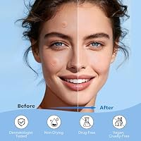 QUSTERE Pimple Patches for Face, Hydrocolloid Acne Patches, Cute Round Shape Zit Covers, Spot Stickers with Tea Tree, Salicylic Acid & Cica Oil| 2 Sizes (9mm, 12mm) |288 Count — image 4