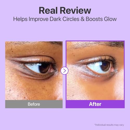 Image of No.9 NAD+ Retinol Peptide Eye Cream 15 ml Retinol Under Eye Serum Dark Circles, Fine Lines Wrinkles Hydrating, Firming Brightening Peptides Niacinamide Glow Treatment Daily Use Under Eye Care