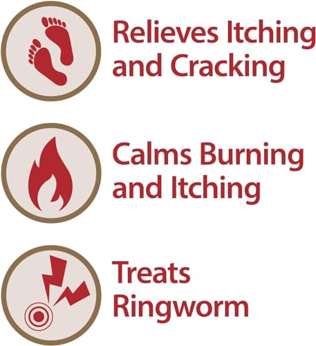 globe clotrimazole antifungal cream 1 usp 1 oz anti fungal treatment relieves itching burning cracking and scaling associated athletes foot jock itch ringworm and more