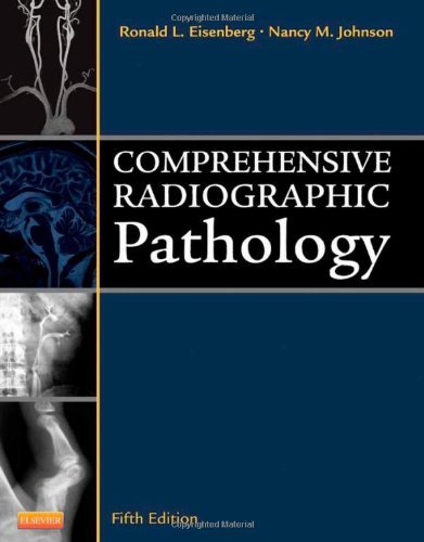By Ronald L. Eisenberg MD JD FACR, Nancy M. Johnson BA RT(R)(CV)(CT)(QM) MEd:Comprehensive Radiographic Pathology, 5e Fifth (5th) Edition (5/E) TEXTBOOK (non Kindle) [PAPERBACK]