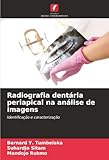  Radiografia dentária periapical na análise de imagens: Identificação e caracterização