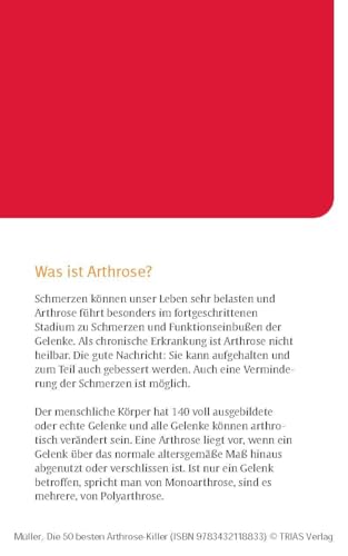Die 50 besten Arthrose-Killer