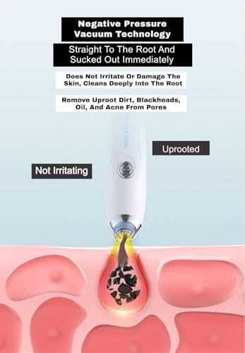 Image of 4 in 1 Multi-Function Blackhead Whitehead Extractor Remover Device, Skin Cleaner, Pimple Removal Tool, Acne Pimple Pore Cleaner Vacuum Suction Tool for Men and Women (White)