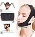 YeyHaiza 2 Pack Chin Strap for Sleeping, Adjustable Jaw Support Chin Strap to Keep Mouth Closed, Anti Snoring Devices Breathable and Durable, Snore Stopper for CPAP Users