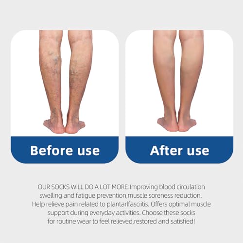 4/6 Pairs Compression Socks for Women Men Circulation-Best Support for Nurses,Running,Athletic,Travel4