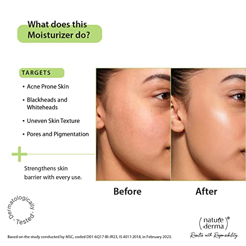 Image of 1% Natural Biome-Boost Moisturizer with Subligana | Helps Reduce Acne and Blemishes| For Soothed, Strengthened Skin | 50ml | Dermatologically Tested