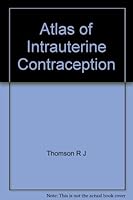 ATLAS INTRAUTERINE CONTRACEPTION 0891162461 Book Cover