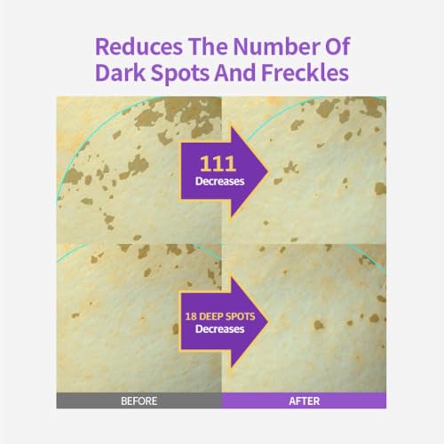 Image of SUNGBOON EDITOR Meoru Podo Vita C Dark Spot Ampoule 30ml | Korean Face Serum with Vitamin C, Niacinamide & Hyaluronic Acid | Dark Spot Corrector, Brightening Serum, Hyperpigmentation, Uneven Skin Tone & Glow Care
