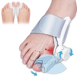 JOLAYSO Bunion Corrector, Adjustable Knob Bunion Brace Splint for Big Toe Relief, Hammer Toe Straightener, with Toe Separator, Suitable for Left and Right Feet