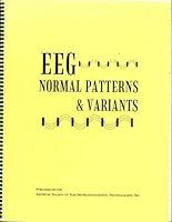EEG Normal Patterns & Variants 157797011X Book Cover