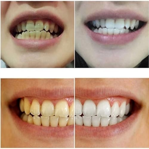 Image of Activated Charcoal Toothpaste ? 105g Black Gel with Bamboo Charcoal for Deep Clean & Plaque Removal ? Ayurvedic, Herbal, Fluoride-Free pack of 1