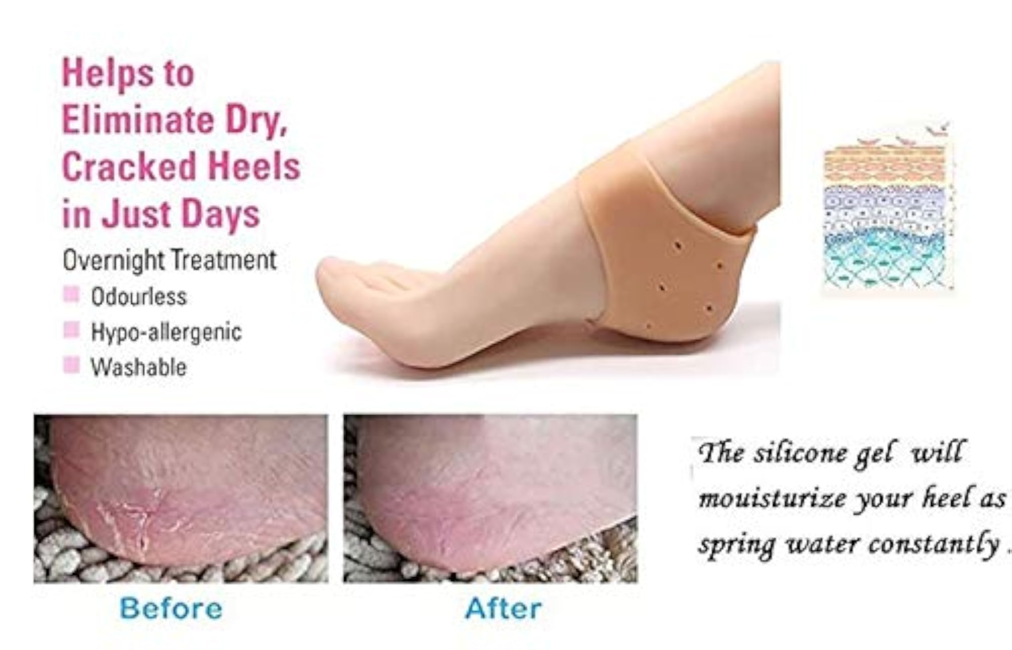 Moisturizing Silicone Gel Anti Crack Half Heel Socks