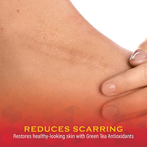 Scar Zone Burn Pain Relief Gel - Extra Strength Topical Analgesic, Treats Minor Cuts, Burns And Abrasions - (0.5 Oz, Pack Of 1) #TOP3