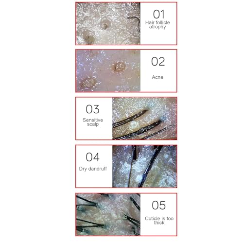 Image of Body Tech Solution Skin Hair Analyzer - 9-Inch LCD Digital Microscope with 50X /200X Magnification, Rechargeable Portable Scalp & Hair Follicle Oil Moisture Detector