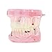Dentalmall Teeth Model Teeth Typodonts Dental Implant Study Analysis Demonstration Teeth Model #2001 with Restoration Pink