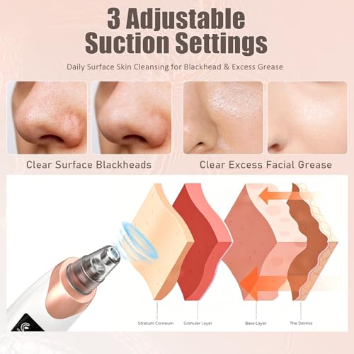 Blackhead Remover Pore Vacuum Kit