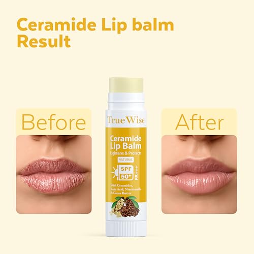 Image of Natural Lip Balm with SPF 50 PA+++ | Brightens Lip Balm For Dark Lips | Kojic Acid & Niacinamide,Vitamin E | Repairs Chapped & Dry Lips | Soft, Glossy Lip for Women & Men 5g