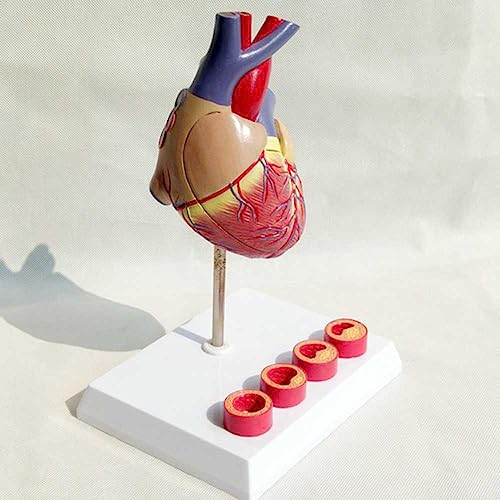 Modèle de cœur 3D AMITD à 2 pièces détachables pour simuler les thrombus - 5