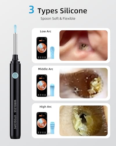 Qimic Ohrenschmalz Entferner mit Kamera, 1080P HD WiFi Otoskop, 3,5mm Linse, 360° Weitwinkel, IP67 Wasserdicht, 6 LEDs, USB-C Aufladung, kompatibel mit iOS & Android - Schwarz