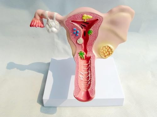 Aides pédagogiques à l'anatomie de l'ovaire pour cabinet médical