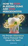 How to Stop Bleeding Gums and Stop Periodontitis: My Proven Alternative Home Protocol That Saved My Teeth