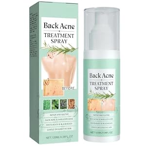 Back Acne Treatment Spray, Back Acne Spray for Backs & Body, Soothes Back-Skin and Moisturizes, 120ml