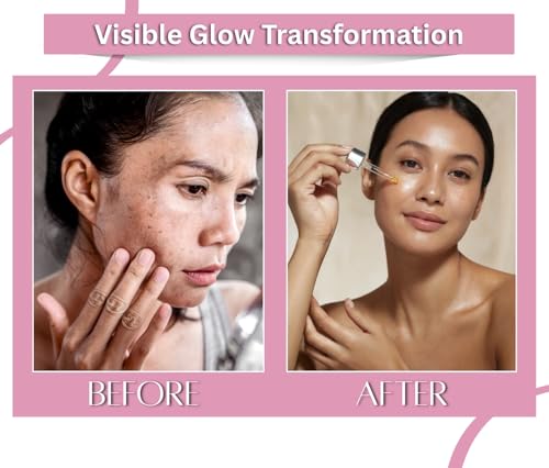 Image of Earth N Pure Rose (Gulab Oil) Essential Oil Natural and Therapeutic Grade with Glass Dropper 30 ml