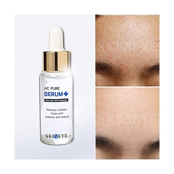 SKINEYE-AC-Pure-Serum SKINEYE AC Pure Serum