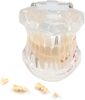 Tooth Model Transparent Typodont Teeth Model, Removable Dental Teeth Model for Patient and Dental Student Education