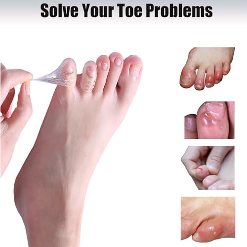 Image of Silicone Anti-Friction Toe Protector, 40 Pcs Gel Toe Protectors with Breathable Hole, Soft Clear Toe Covers for Pain Relief, Silicone Toe Protectors Caps Guards for Corns