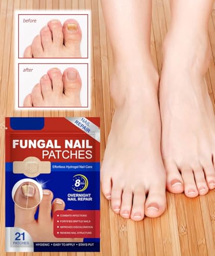 Image of Advanced Fungal Nail Patch Treatment (20 PATCH) Powerful Antifungal Solution | Targets Nail Fungus at the Root | Easy-to-Use Patch for Toenail & Fingernail