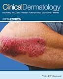 Clinical Dermatology