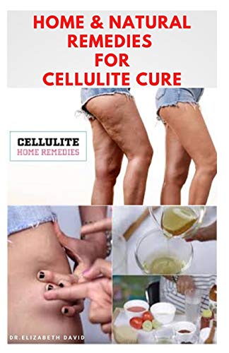 HOME & NATURAL REMEDIES FOR CELLULITE CURE: Practical Guide On The Best Remedies To Get Rid Of Your Cellulite : Everything You Need To Know