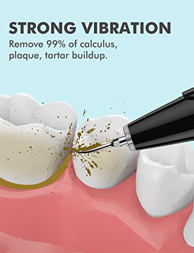 Electric Teeth Cleaning Tool For Home Tooth Care, 5 Modes, Usb Rechargeable, 2 Replacement Heads, Led Light, Portable Teeth Cleaner Kit For Beginner #TOP1