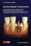 implantat kosten  Champions-Implants - Das MIMI-Verfahren