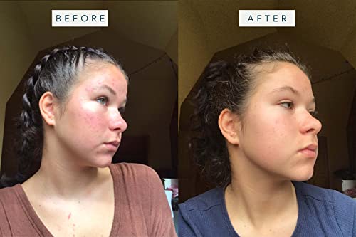 Brandefy Daily Triple - Niacinamide Serum, Peptides And Hyaluronic Acid. Hydrating & Plumping Serum For Bright, Smooth, Firm & Dewy Skin, 1.7Oz, Made In The Usa #TOP3