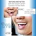 Instant Smile Comfort Fit Flex Natural Shade - Slightly Imperfect - with 2 extra fitting bead bags. One size fits most people.