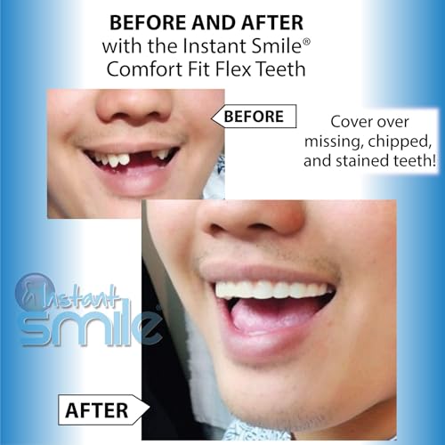 Image of Instant Smile Flex Teeth (Natural Shade) and Pro Series Tooth Kit - 2 great Instant Smile Products