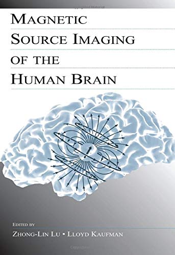 Magnetic Source Imaging of the Human Brain