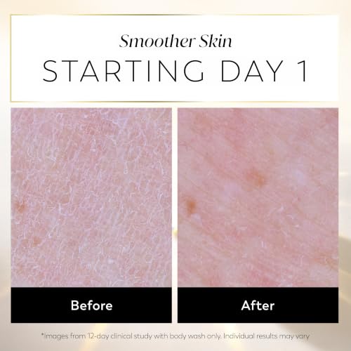 Image of Olay Daily Renewing Body Lotion for Women, 96HR Moisture, Lightweight Fast-Absorbing Repair Care, with Vitamin B3 & Retinol, Free of Parabens & Phthalates, Vanilla Creme & Sandalwood Scent, 17 fl oz