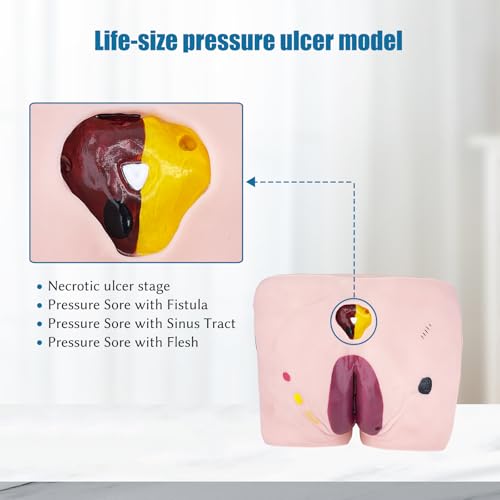 Image of JNMFTD Geriatric Decubitus Ulcer Nursing Model, 4 Stages Pressure Ulcers Advanced Nursing Elderly Bedsore Human Model Wound Kit with Product Manual Card for Hospital Medical Education Study