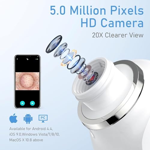 Image of HD Camera USB Blackhead Remover Vacuum, 3 Modes 6 Suction Heads | 1080P lens & 8 LED fill lights, 20x skin magnification, photo & video capture, long-lasting battery, full accessory kit
