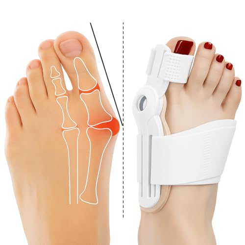 Protetor de Bunion Ortopédico - Alivia a Dor e Previne Lesões