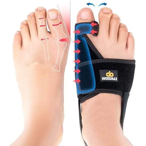 INDEEMAX Bunion Corrector for Women Men, Adjustable Orthopedic Bunion Splint, Non-Surgical Big Toe Hammer Straightener for Day & Night Hallux Valgus Pain Relief 2 Pcs Cover