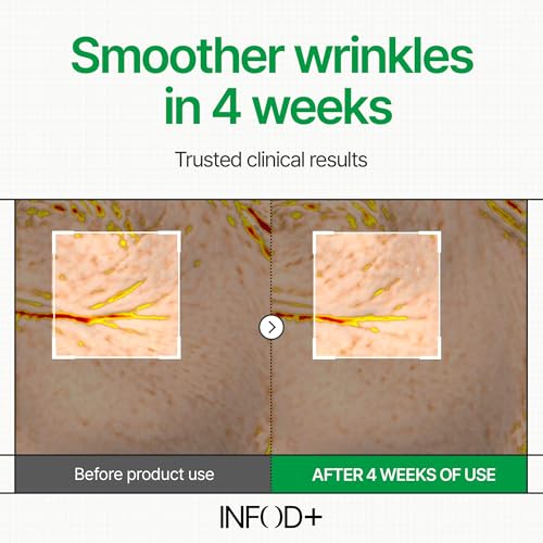 INFOD+ INFODPLUS Sensitive Skin Moisturizer Face Cream with Ceramide and Panthenol, Barrier Repair Support Hydrating Soothing Cream, Lightweight Calming Facial Moisturizer, Korean Skincare 1.69 fl oz, 50ml