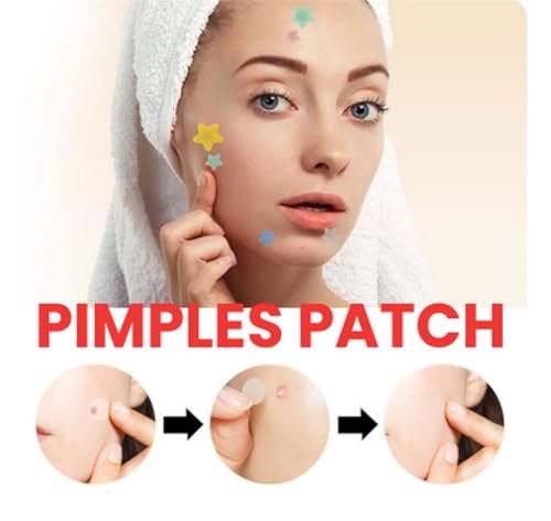 Okian Patch de espinhas, tratamento hidrocolóide para acne, para cobrir espinhas, 200 unidades
