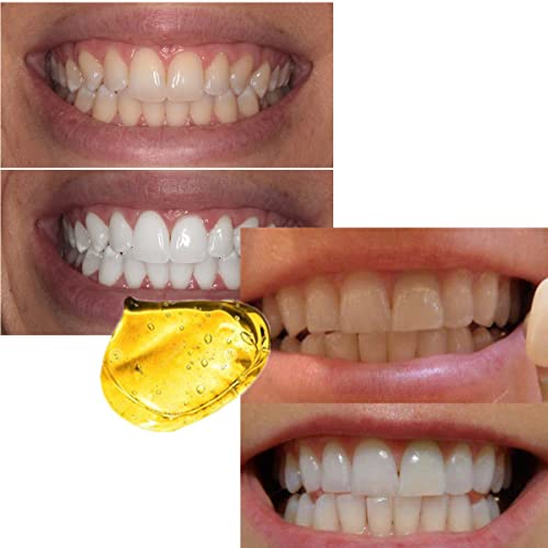 Image of 24K Gold Professional Dental Dentist Bright White Tooth Whitening Bleaching System Gel Remove Yellow Stain Tools