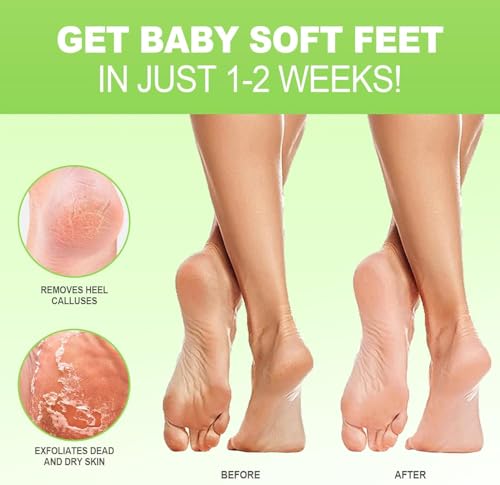 Jvr Foot Peel Mask - 3 Pairs - Exfoliating Peeling Callus Remover, Repairs Cracked Heels & Dry Skin, For Smoother And Softer Feet thumb #1