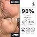 7E Wellness MyoLift Mini Microcurrent Facial Device - Non-Invasive Microcurrent Facial Device, Facial Skin Care Products for Anti Aging, Skin Tightening - Esthetician Supplies & Skin Care Tools -Face